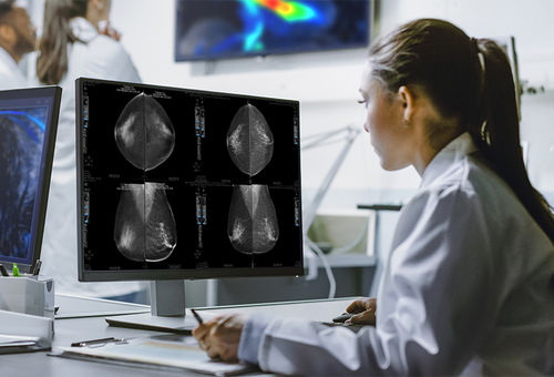 Analysis artificial intelligence platform - Arterys - breast density measurement / reporting / viewer
