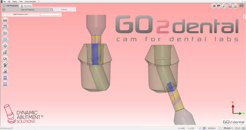 CAM software - GO2dental - Dynamic Abutment Solutions - for dental laboratories