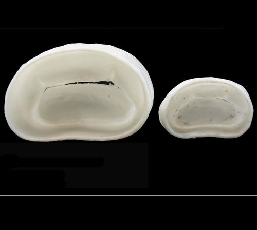 Mitral valve model - 3D Lifeprints UK Ltd - robotic surgery / training