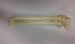 Bone model - 3D Lifeprints UK Ltd - radius / cubitus / elbow
