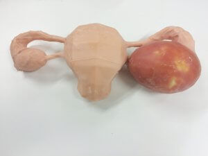 Ovary model - 3D Lifeprints UK Ltd - robotic surgery / for ovariohysterectomy