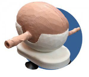 Bladder model - 3D Lifeprints UK Ltd - endoscopy