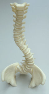 Vertebral column model - 3D Lifeprints UK Ltd - scoliosis
