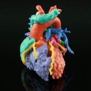 3D printing software - HeartPrint - Materialise UK - planning / medical / anatomy