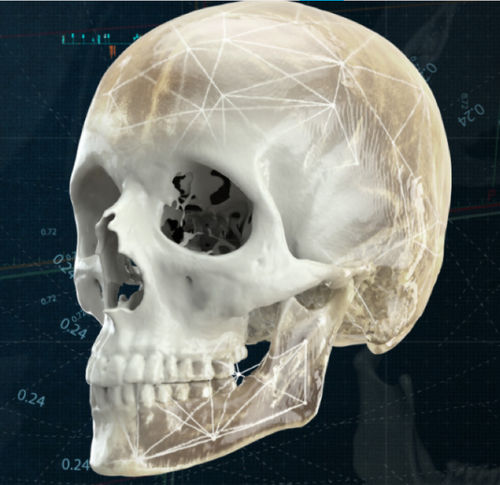 3D viewing software - CMF - Materialise UK - analysis / planning / 3D simulation