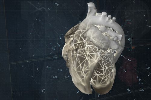Visualization software - Materialise UK - diagnostic / acquisition / planning