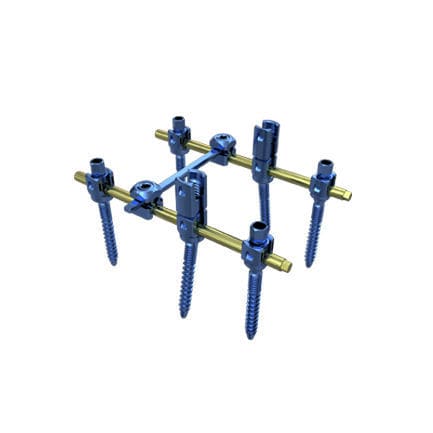 Thoraco-lumbar osteosynthesis unit - Irene Ortho - posterior / adult