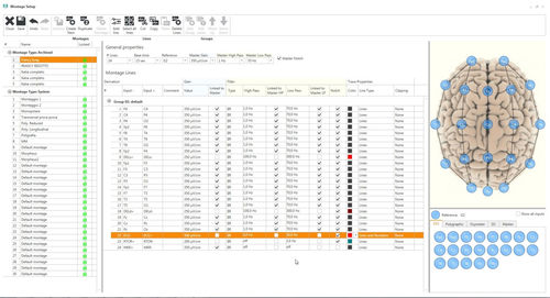 Analysis software - Micromed Italy - data analysis / management / monitoring