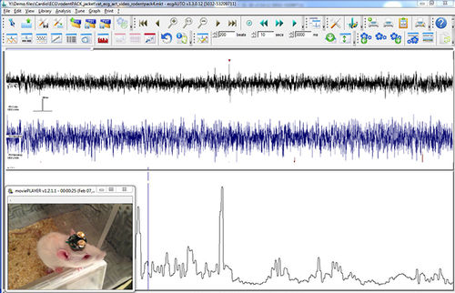 Medical software - EEG+ - emka TECHNOLOGIES - EMG / cardiovascular / neurological