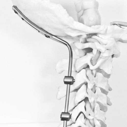 Occipito-cervical osteosynthesis unit - J.O.C. - NEURO FRANCE Implants - posterior / adult