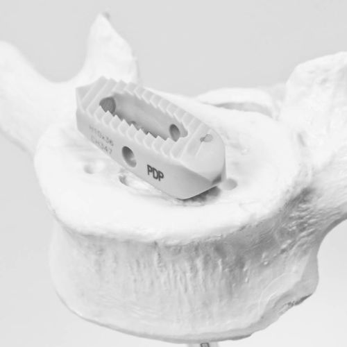 Thoraco-lumbar interbody fusion cage - P.D.P - NEURO FRANCE Implants - posterior / transforaminal / PEEK