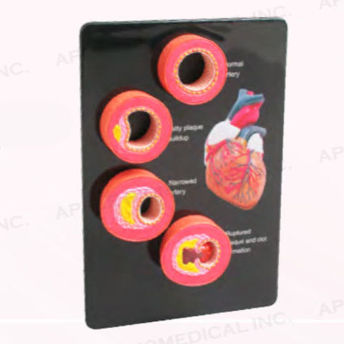 Handheld anatomical model - A534 - Apple Biomedical - artery / for teaching / pink