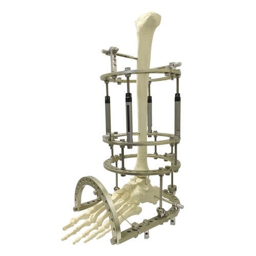 Ankle external fixation system - FES05  - Selaz - circular / adult
