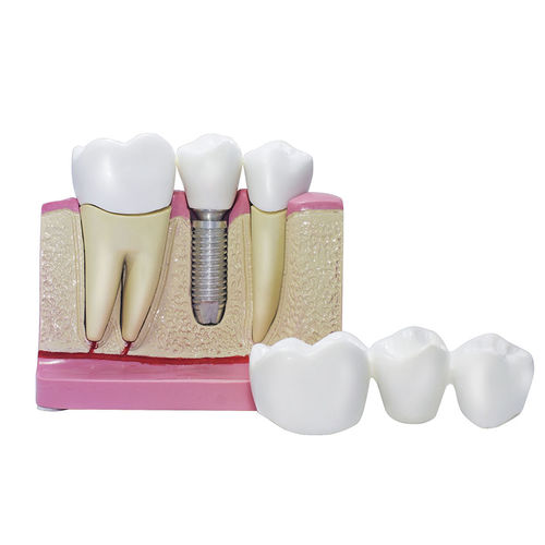 Dental model - 8007  - Nacional Ossos - for implantology / dental prosthetics / training
