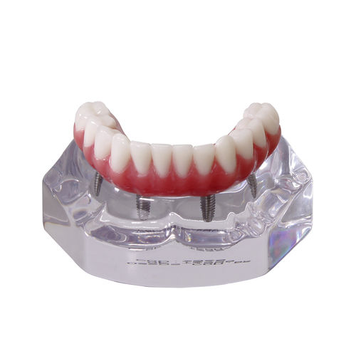 Denture model - 9568 - Nacional Ossos - for implantology / dental prosthetics / for teaching