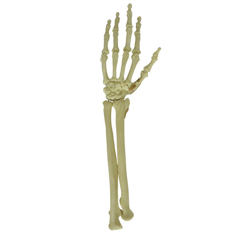Bone model - 9706 - Nacional Ossos - wrist / orthopedic surgery / training