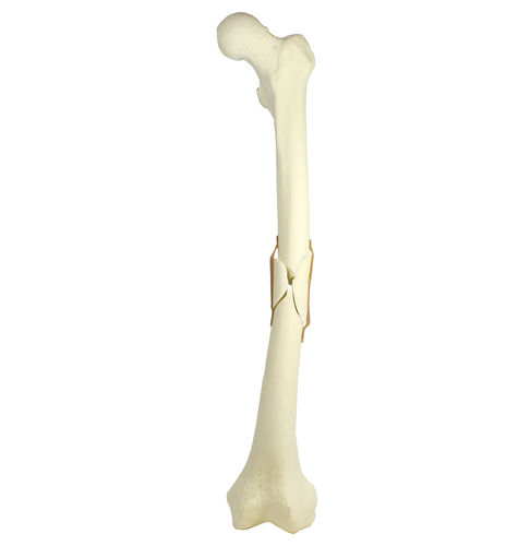 Bone model - 9703 - Nacional Ossos - femur / orthopedic surgery / training