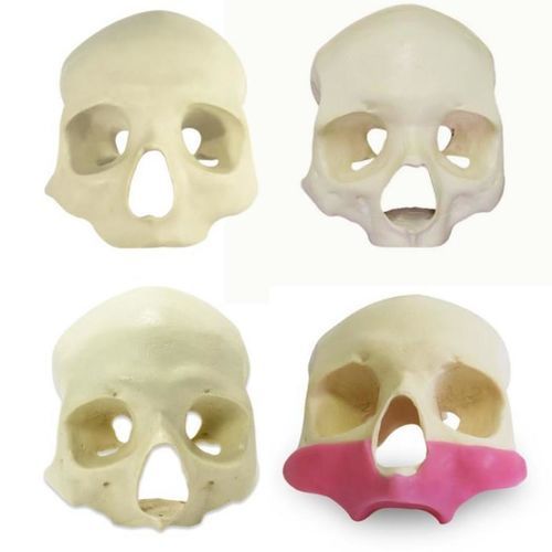 Skull model - 9014G ALL-ON-4 - Nacional Ossos - sinus / gingival / for implantology