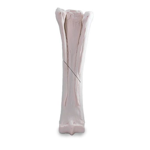 Metacarpal anatomical model - 15714 - Nacional Ossos - bone / training / for demonstration