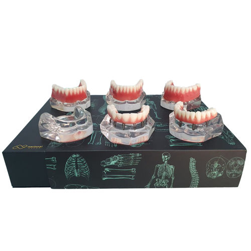 Mandible model - 9768 - Nacional Ossos - denture / maxilla / dental care
