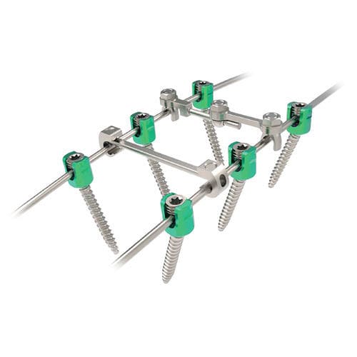 Thoraco-lumbar osteosynthesis unit - Rapidfix  - NORMMED Medical Devices - posterior / adult