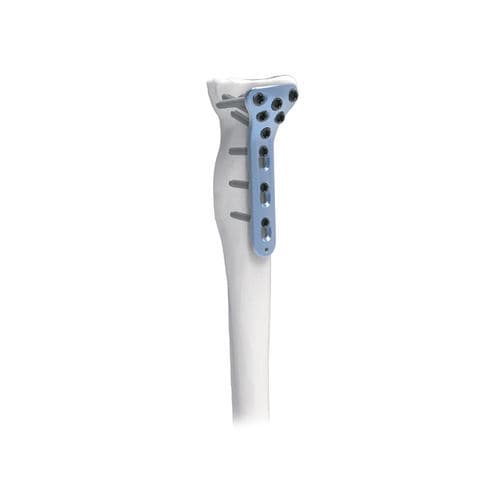 Radius compression plate - PNM1034 - NORMMED Medical Devices - proximal / locking / metallic