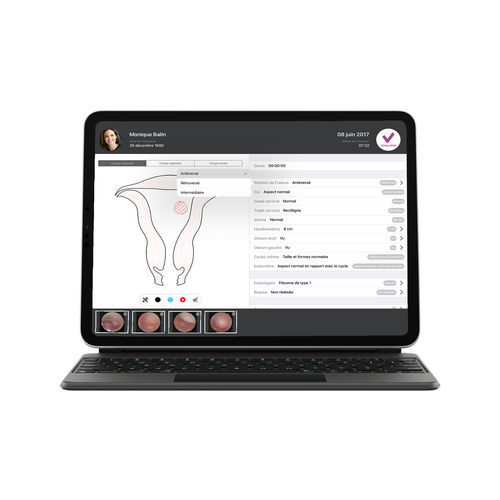 Medical software - imagyn® license - Delmont imaging - medical imaging / gynecology / data management