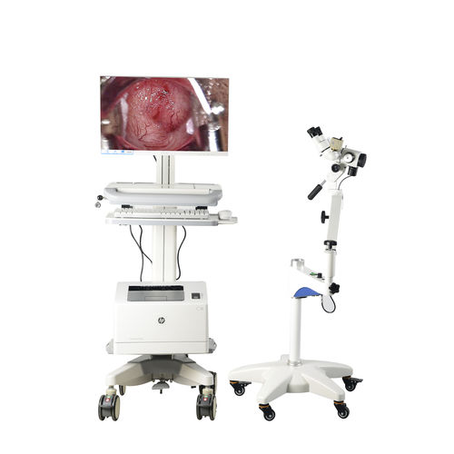 Video colposcope - FD-10C - Hunan Fude Technology - binocular / trolley-mounted