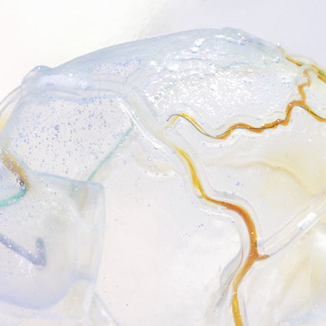 Coronary arteries vascular model - CTO  - JMC Corporation - cardiovascular catheterization / transparent