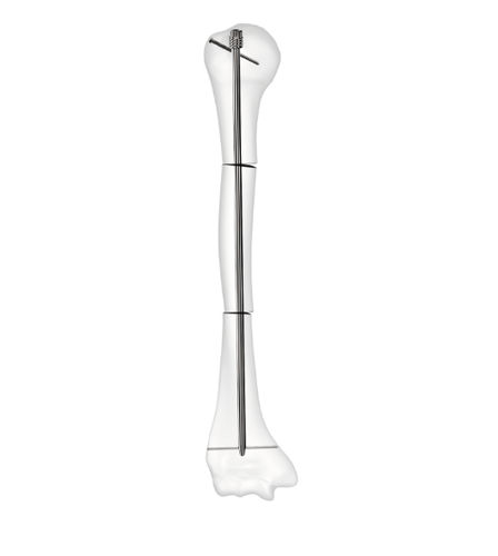 Humeral intramedullary nail - D-Scope - Peditst - stainless steel