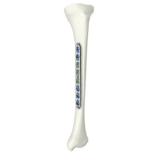Humerus compression plate - 317270000 series - Peditst - tibia / locking / titanium