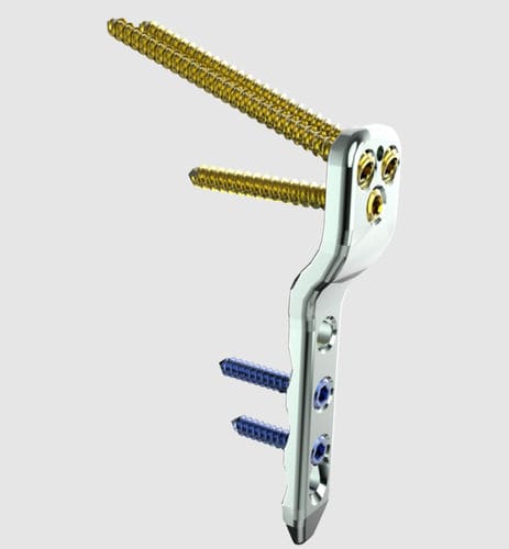 Femur osteotomy plate - 31610 series - Peditst - proximal / locking / stainless steel