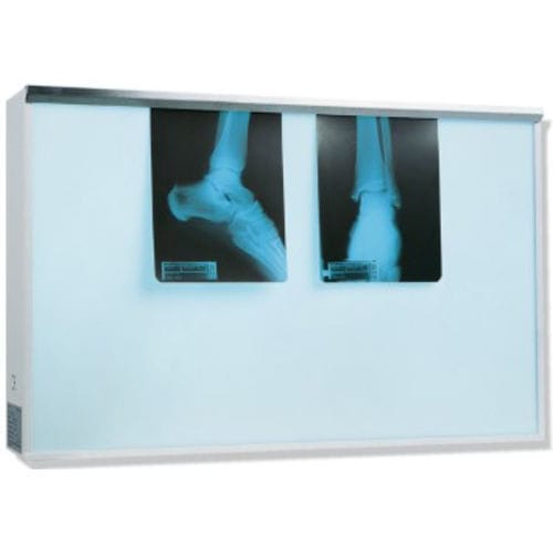 2-screen X-ray film viewer - K606671 - Karrel Health Solutions - white light / with switch