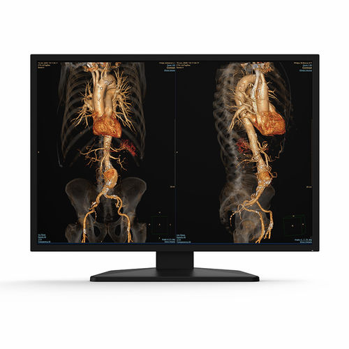Medical display - 31X12C - KTC Medical Solutions - diagnostic / radiology / 4K