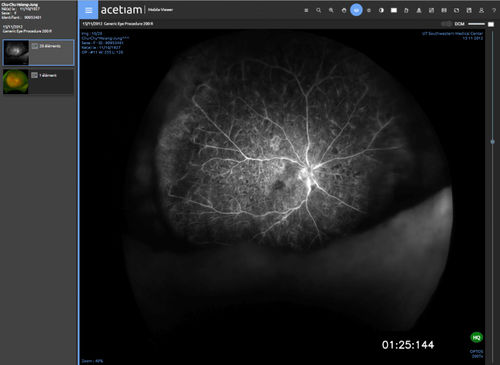 Viewer software - vieviewer Clinic - NEHS DIGITAL - sharing / import / medical
