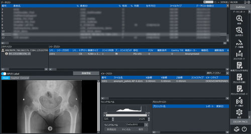 Viewer software - ZedView2.5D  - LEXI Co. - planning / treatment / import