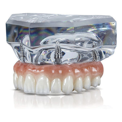 Dental model - BruxZir® - Glidewell Direct - for implantology / for demonstration