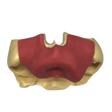Sinus anatomical model - ZYG - 102  - Selmodels SL - for dental surgery / for sinus lift