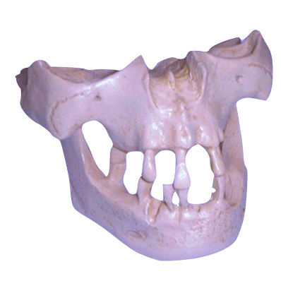 Bone model - DM – 142  - Selmodels SL - sinus / side / for implantology
