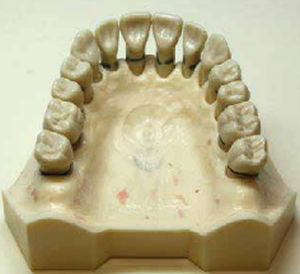 Bone model - DM 127 - Selmodels SL - teeth / for periodontics / for dental diseases