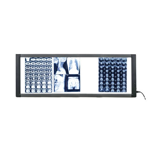 Digital X-ray film viewer - MG04 - Nanchang Micare Medical Equipment - 4-screen / with switch / LED