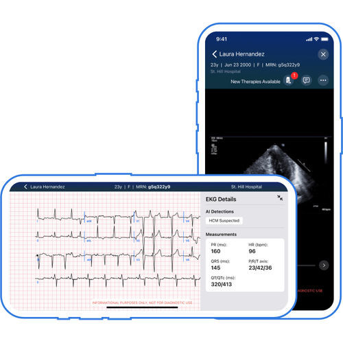 Treatment mobile application - Viz.ai - reporting / diagnostic / for ECG