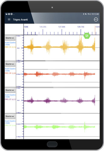 Visualization software module - EMG Plots - Delsys - treatment planning / training / EMG