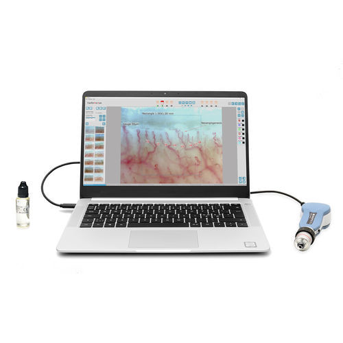 Video capillaroscope - DM-120 CapiScope series - Inspectis - computer-based