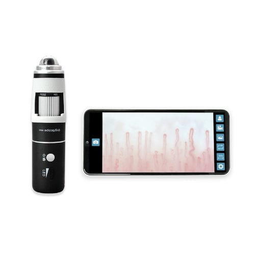Video capillaroscope - DM-110 DigiScope - Inspectis - smartphone-based / tablet-based