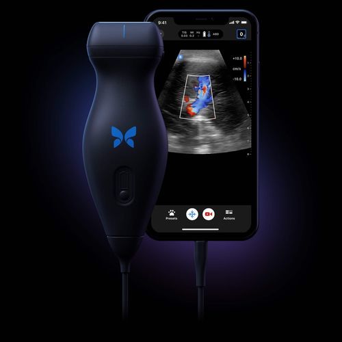 Hand-held veterinary ultrasound system - Butterfly Network ...