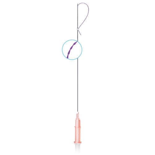 Resorbable lifting thread - Cog Master Gear - W&O medical esthetics - notched / smooth