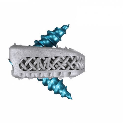 Cervical interbody fusion cage - Magnolis® Z - Maxxspine Innovative - anterior