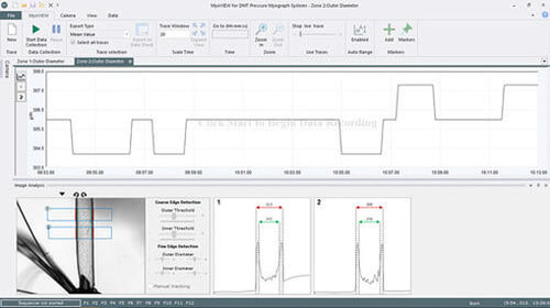 Analysis software - MyoVIEW - Danish Myo Technology A.S (DMT) - management / for control / acquisition