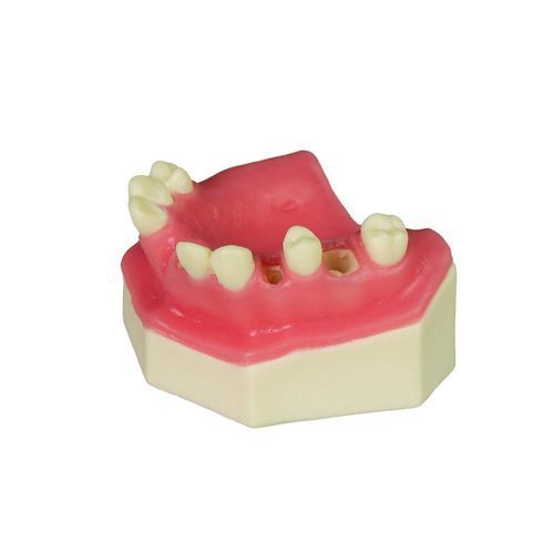 Dental model - JG-YZ-15 - FOSHAN JINGLE MEDICAL EQUIPMENT CO., LTD - gingival / bone / surgical